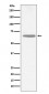 Anti-CHAT/Choline Acetyltransferase Rabbit Monoclonal Antibody