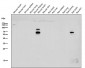 Anti-CHAT/Choline Acetyltransferase Rabbit Monoclonal Antibody