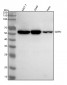 Anti-G6PD/Glucose 6 Phosphate Dehydrogenase Rabbit Monoclonal Antibody