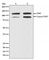 Anti-PARP PARP1 Rabbit Monoclonal Antibody