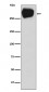 Anti-MRP1 ABCC1 Rabbit Monoclonal Antibody