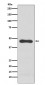 Anti-PAI1 Rabbit Monoclonal Antibody