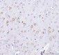 Anti-ULK1/Atg1 Rabbit Monoclonal Antibody