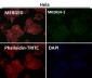 Anti-Actin ACTA1 Rabbit Monoclonal Antibody