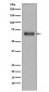 Anti-TGFBI/Beta Ig H3 Rabbit Monoclonal Antibody