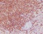 Anti-Bcl-2 Rabbit Monoclonal Antibody