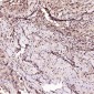 Anti-Bcl-2 Rabbit Monoclonal Antibody