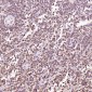 Anti-Bcl-2 Rabbit Monoclonal Antibody