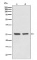 Anti-Bcl-2 Rabbit Monoclonal Antibody