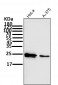 Anti-Bcl-2 Rabbit Monoclonal Antibody