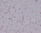 Anti-Olig2 Rabbit Monoclonal Antibody