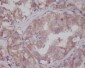 Anti-LRRK2 Rabbit Monoclonal Antibody