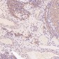 Anti-TRAF6 Rabbit Monoclonal Antibody