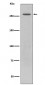 Anti-LRRK2 Rabbit Monoclonal Antibody