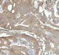 Anti-STAT1 Rabbit Monoclonal Antibody