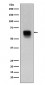 Anti-MMP14/Mt1 Mmp Rabbit Monoclonal Antibody