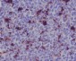 Anti-MERTK/Mer Rabbit Monoclonal Antibody