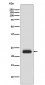 Anti-RAIDD Rabbit Monoclonal Antibody