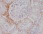 Anti-TGFBI/Beta Ig H3 Rabbit Monoclonal Antibody