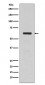 Anti-TGFBI/Beta Ig H3 Rabbit Monoclonal Antibody