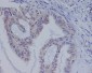 Anti-B Raf Rabbit Monoclonal Antibody
