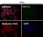 Anti-ROCK1 Rabbit Monoclonal Antibody