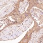 Anti-ROCK1 Rabbit Monoclonal Antibody