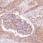 Anti-ROCK1 Rabbit Monoclonal Antibody