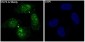 Anti-STAT6 Rabbit Monoclonal Antibody