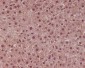 Anti-STAT6 Rabbit Monoclonal Antibody