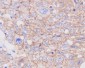 Anti-GLUT1 SLC2A1 Rabbit Monoclonal Antibody