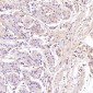 Anti-GLUT1 SLC2A1 Rabbit Monoclonal Antibody