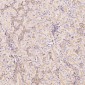 Anti-GLUT1 SLC2A1 Rabbit Monoclonal Antibody