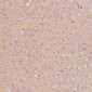 Anti-GLUT1 SLC2A1 Rabbit Monoclonal Antibody