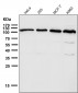 Anti-ABCG1 Rabbit Monoclonal Antibody