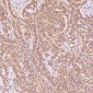 Anti-EpCAM/Trop1 Rabbit Monoclonal Antibody