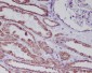 Anti-Hsp60 HSPD1 Rabbit Monoclonal Antibody