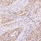 Anti-Hsp70 HSPA1A Rabbit Monoclonal Antibody