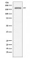 Anti-CD11a ITGAL Rabbit Monoclonal Antibody