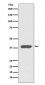 Anti-CXCR7 ACKR3 Rabbit Monoclonal Antibody