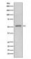 Anti-MMP11 Rabbit Monoclonal Antibody