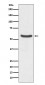 Anti-GLUT2 Rabbit Monoclonal Antibody