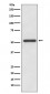 Anti-MMP13 Rabbit Monoclonal Antibody