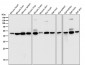 Anti-DUSP1/Mkp 1 Rabbit Monoclonal Antibody