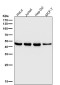 Anti-DUSP1/Mkp 1 Rabbit Monoclonal Antibody