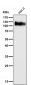 Anti-LAMP1/Cd107A Rabbit Monoclonal Antibody