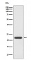 Anti-PRDX1/Peroxiredoxin 1 Rabbit Monoclonal Antibody