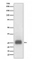 Anti-TIMP1 Rabbit Monoclonal Antibody