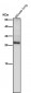 Anti-TIMP1 Rabbit Monoclonal Antibody