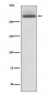 Anti-LAMA3/Laminin 5 Rabbit Monoclonal Antibody